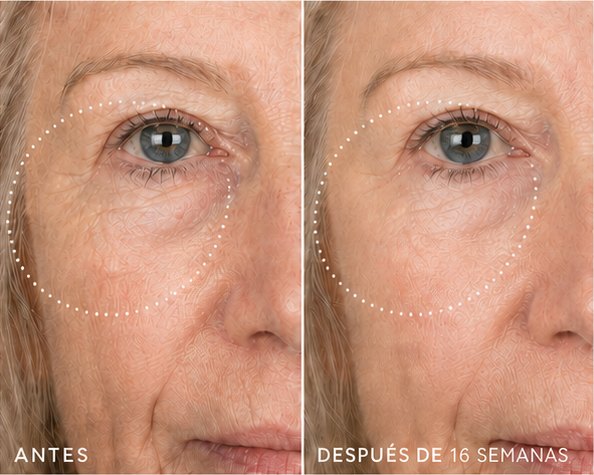 Antes y después